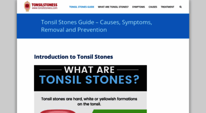 tonsilstoness.com
